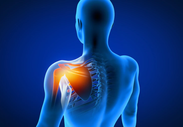 What are the Symptoms of Shoulder Arthritis?