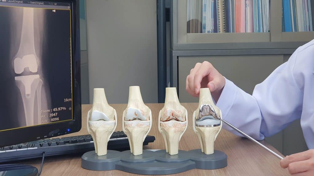 What is Oxinium Knee Replacement Surgery?