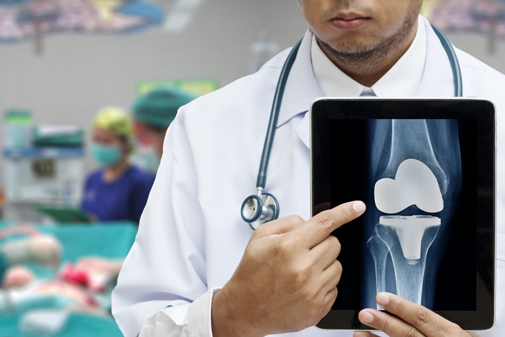 Benefits of Computer Navigated Knee Replacement Surgery
