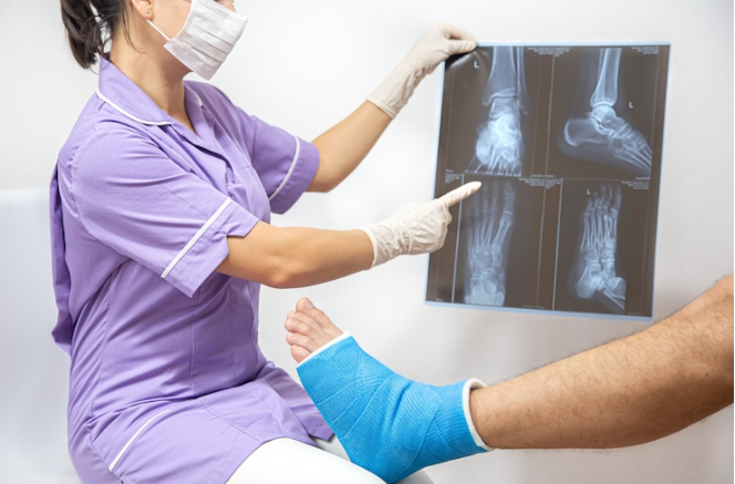 When Can I Return to Work After Bone Fracture?