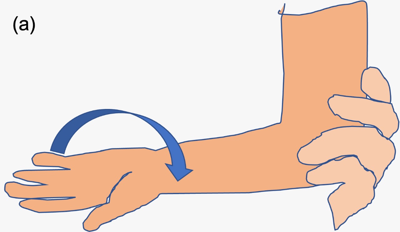 Supination-flexion manoeuvre (A)