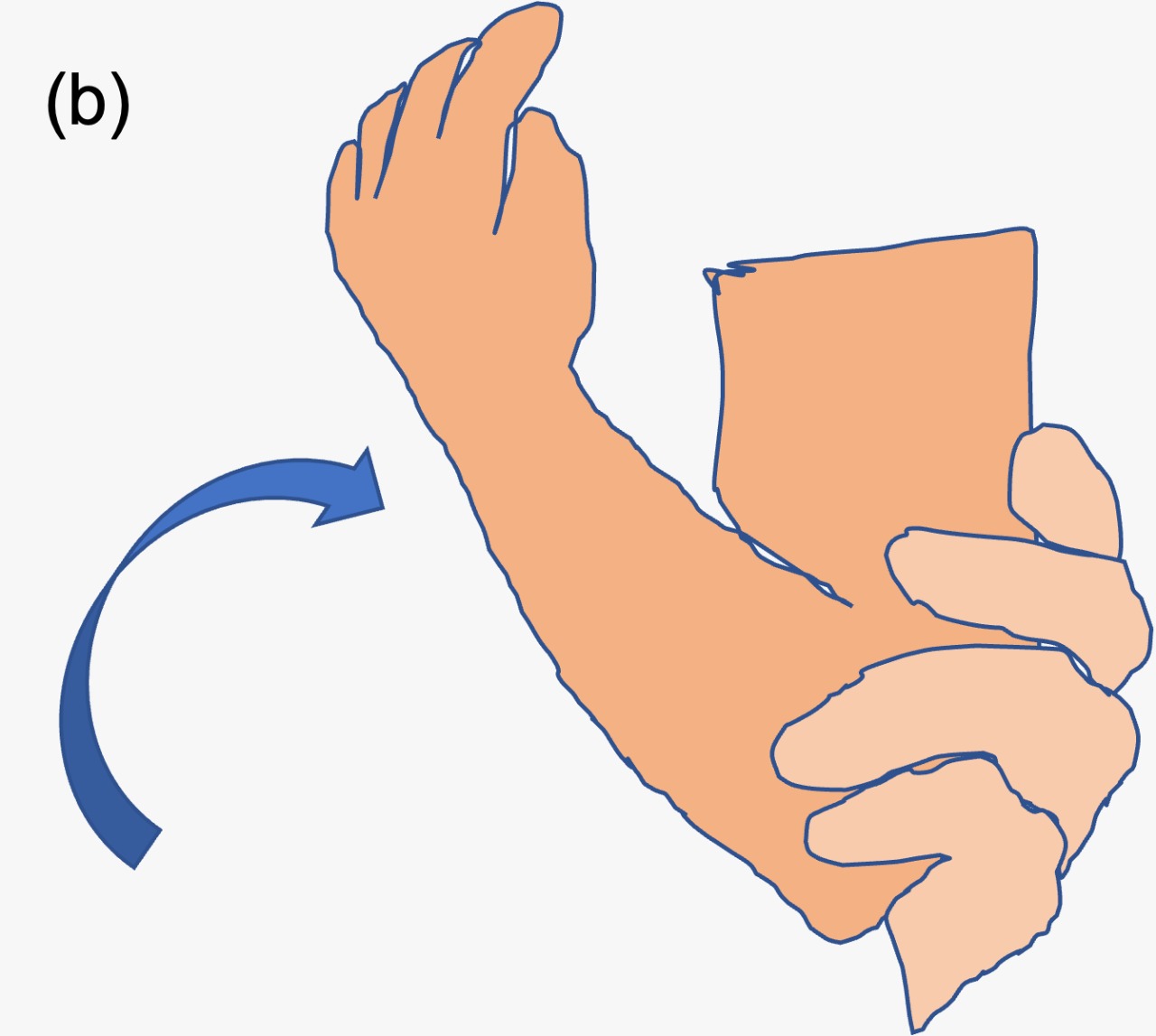 Supination-flexion manoeuvre (B)