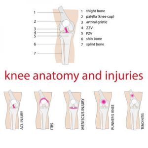 Types of Knee Ligament Injuries