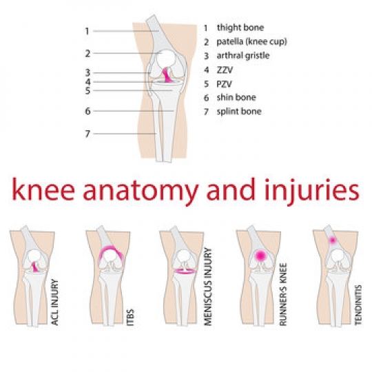 Types of Knee Ligament Injuries