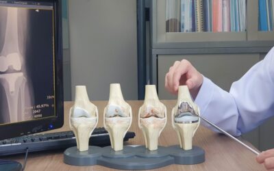 How Robotics is Revolutionizing Joint Replacement?