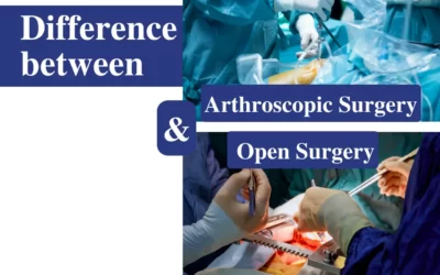 Difference between Arthroscopic surgery & Open surgery