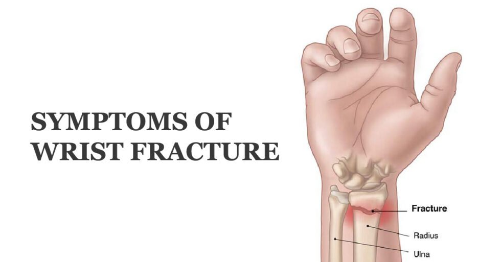 Hand and Wrist Fracture: Symptoms, Types and Treatment