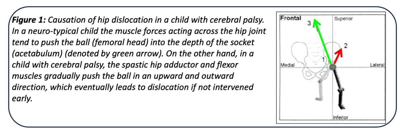 children hip problems with cerebral palsy