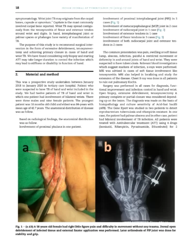 DR PARAG LAD TB HAND ARTICLE_page-0002