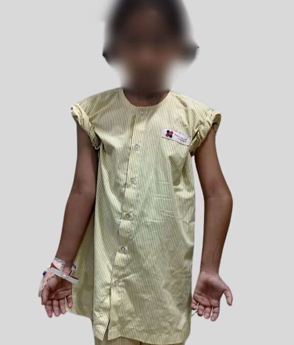 Elbow Cubitus varus deformity in 8 Years old child