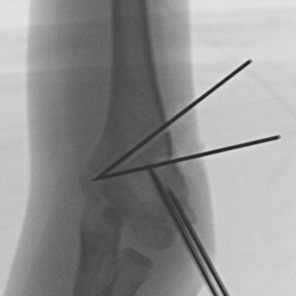 Intra-operative C-arm images