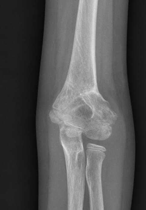 post-operative clinical photograph and X-ray