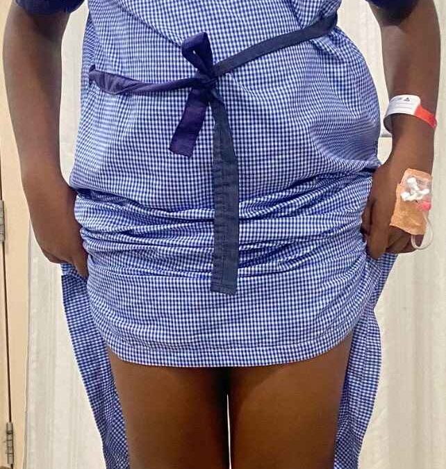 Knee Genu valgum deformity in 12 Years Old Male Child