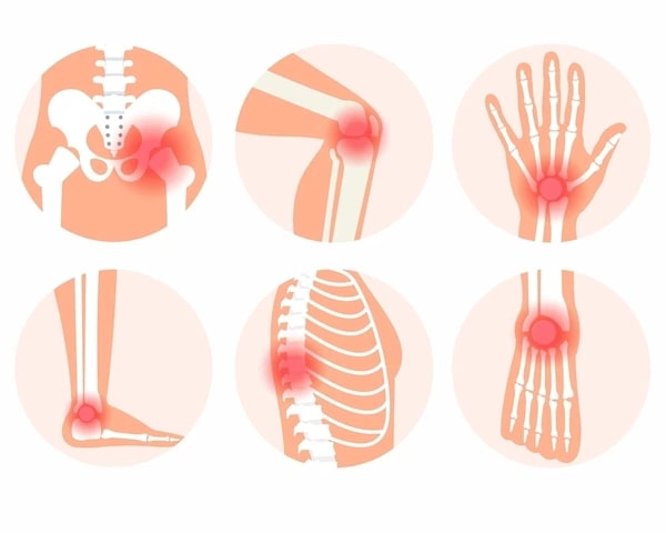 Arthritis Affect Mental Health