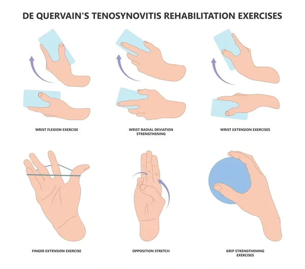 De Quervain’s Tenosynovitis Exercises