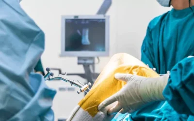 Robotics Technology in Joint Replacement Surgery