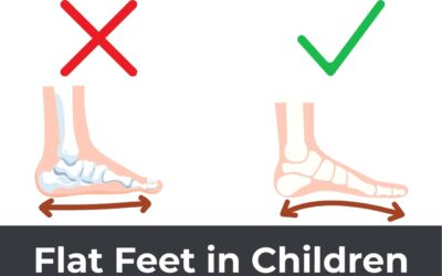 Flat Feet in Children: Myths and Facts