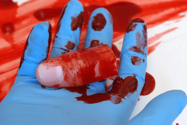severed finger severed finger