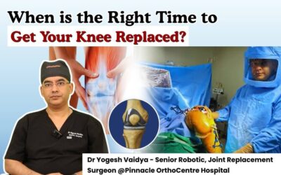 When Is the Right Time for Knee Replacement Surgery?