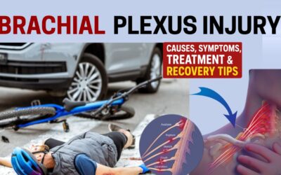 Brachial Plexus Injury: Causes, Symptoms & Treatment Explained