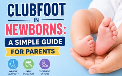Clubfoot in Newborns: A Simple Guide for Parents