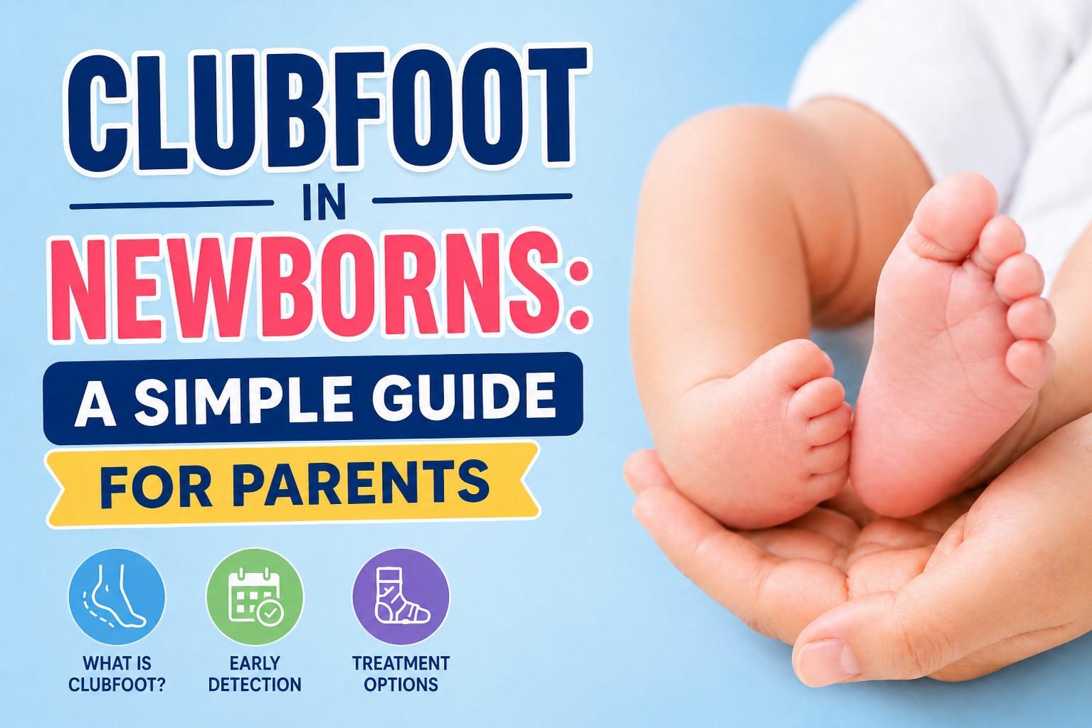 Clubfoot in Newborn