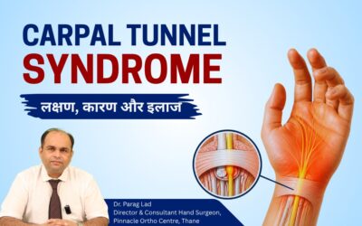 Understanding Carpal Tunnel Syndrome