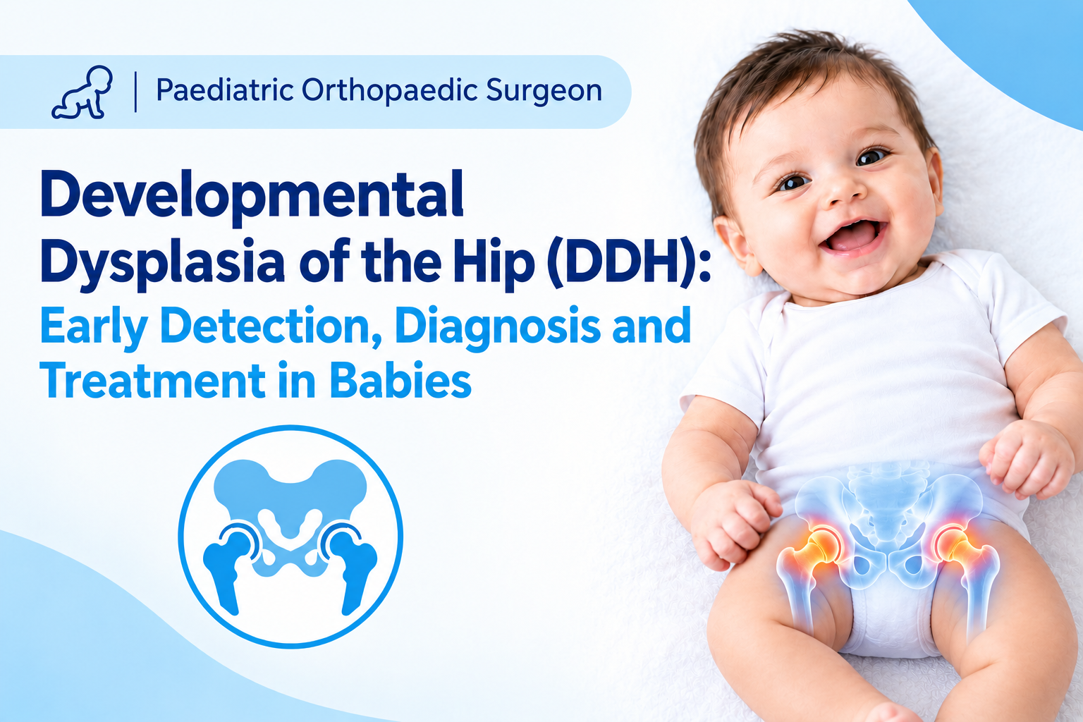 Developmental Dysplasia of the Hip